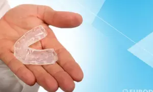 Mano che tiene un bite trasparente. Questo dispositivo, se usato correttamente, può aiutare a correggere la posizione dei denti.