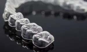 Mascherine trasparenti per allineamento dentale, un esempio di come si presentano i denti con Invisalign. Ogni quanto si cambiano le mascherine?
