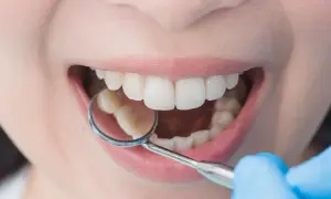 Esame dentale con specchietto. Si nota un lieve affollamento dentale, ma i denti sono ben allineati.