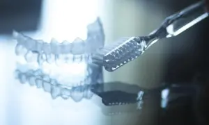Pulire Invisalign è semplice: usa uno spazzolino morbido e acqua tiepida. Mantieni i tuoi allineatori trasparenti sempre impeccabili.