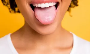 Bocca aperta con lingua rosa che sporge, un po' di bianco si nota, forse perchè ho la lingua bianca. Sorriso smagliante su sfondo giallo.