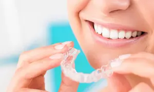 Sorriso smagliante con Invisalign, da indossare 20 ore al giorno per un risultato perfetto.