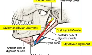 Text excerpt highlighting differential diagnoses for orofacial and cervical pain, including Eagle syndrome.