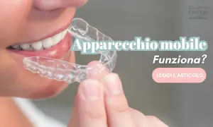Dente allineato con un apparecchio mobile trasparente. Scopri se funziona davvero.