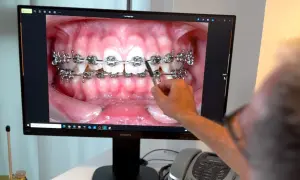 Primo piano di un monitor che mostra un'immagine ravvicinata di denti con apparecchio fisso. Una mano indica l'immagine.
