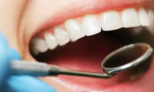 Esame del cavo orale con specchietto dentale. Si osservano denti bianchi e gengive sane, escludendo la presenza di stomatite palato.
