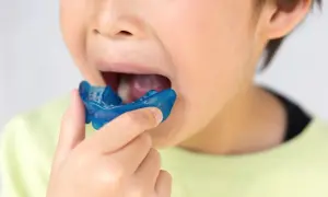 Bambino con apparecchio blu in bocca, parte di un percorso di terapia miofunzionale per migliorare la funzione orale.