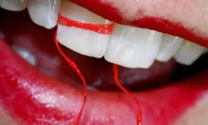 Un filo interdentale rosso avvolge due denti, creando un effetto visivo che sembra allargare i denti. Le labbra rosse incorniciano la scena.