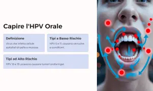 Il virus HPV può infettare la bocca, causando lesioni. Comprendere i diversi tipi di HPV è fondamentale per la prevenzione.