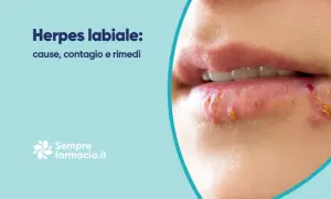 Labbra con herpes, un disturbo comune. Scopri cause, contagio e rimedi per il herpes lingua.