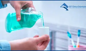 Mano versa collutorio alla clorexidina in un misurino per alleviare le gengive infiammate.
