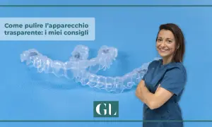 Consigli su come pulire l'apparecchio trasparente. Una donna sorride accanto a un apparecchio dentale trasparente.