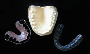 Modello dentale e apparecchi ortodontici, inclusi apparecchi invisibili per adulti, su sfondo nero.