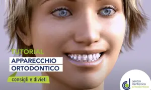 Tutorial apparecchio ortodontico: scopri se si possono mangiare le patatine con l'apparecchio e altri consigli utili.