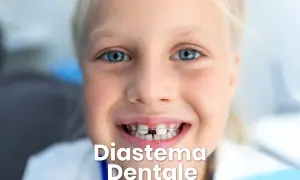 Bambina sorridente con apparecchio ortodontico che corregge lo spazio tra i denti.