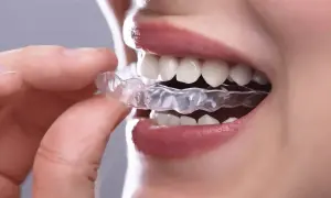 Dita inseriscono un bite dentale trasparente per rilassare la muscolatura.