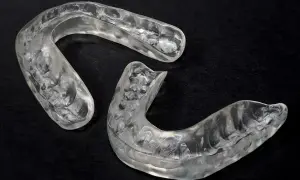 Due bite occlusali trasparenti, sagomati per adattarsi all'arcata dentale, su sfondo nero.