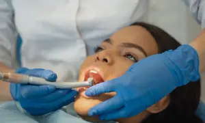 Dottoressa esegue scaling dentale su paziente. Mani con guanti blu tengono strumento odontoiatrico.