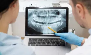 Dentisti analizzano un'ortopanoramica dentale su un laptop, seguendo il principio Alara per minimizzare l'esposizione.