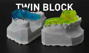 Modelli dentali con apparecchi **twin block ortodonzia** blu e gialli, pronti per correggere la malocclusione.