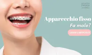 Sorriso con apparecchio fisso. Fa male togliere l'apparecchio fisso? Scopri di più leggendo l'articolo.