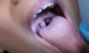 Bocca aperta con lingua e tonsille visibili. Se hai un palato gonfio, rimedi naturali possono aiutare.