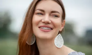 Sorriso smagliante con apparecchio, dimostrando che l'ortodonzia a 50 anni è una scelta di benessere e bellezza.