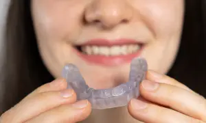 Una persona sorride mostrando un apparecchio trasparente, progettato per allineare i denti e migliorare la salute degli ossa mascellari.