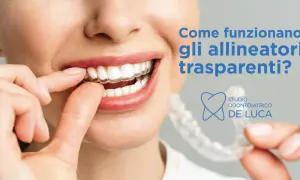 Sorriso smagliante con un apparecchio trasparente. Scopri come funziona questo innovativo trattamento ortodontico.