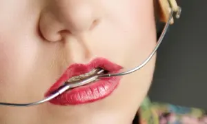 Labbra rosse con apparecchio ortodontico, un dettaglio del viso con un apparecchio baffo che si estende verso l'orecchio.