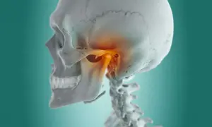 Dettaglio anatomico del cranio e delle vertebre cervicali, con enfasi sull'articolazione temporo-mandibolare (ATM) evidenziata in arancione, suggerendo i sintomi di un disturbo.