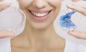 Sorriso smagliante con Invisalign e apparecchio trasparente. Nessun mal di testa, solo denti perfetti.