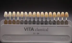 Scala VITA classical per la scelta del colore dei denti. Denti finti di varie tonalità per trovare la perfetta scala vita denti.