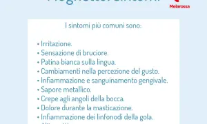 Elenco dei sintomi del mughetto: irritazione, bruciore, patina bianca sulla lingua, alterazioni del gusto, infiammazione gengivale, sapore metallico, crepe agli angoli della bocca, dolore alla masticazione, infiammazione linfonodi, alito cattivo.