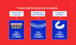 Confronto prezzi per apparecchi ortodontici: linguale, fisso invisibile e allineatori. Le piastrine denti hanno costi variabili.