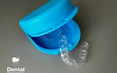 Apparecchio trasparente per correggere la malocclusione 1 classe. Custodia blu aperta con un bite all'interno.