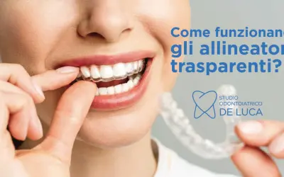 Sorriso smagliante con un apparecchio trasparente. Scopri come funziona questo innovativo trattamento ortodontico.