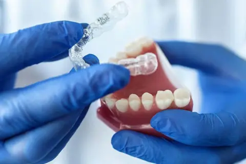 Mani guantate mostrano un bite notturno trasparente su un modello di denti.