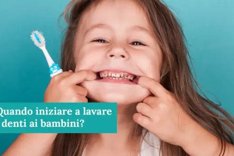 Bambina mostra denti cariati, con spazzolino. La psicologia del non lavarsi i denti può portare a problemi di salute orale fin da piccoli.