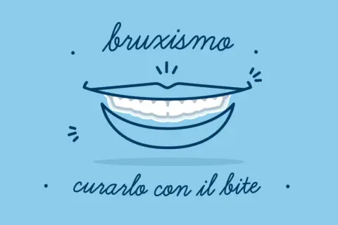 Bruxismo: un sorriso che stringe i denti. Scopri i rimedi, come il bite, per alleviare il serramento notturno.