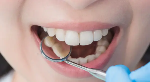 Esame dentale con specchietto. Si nota un lieve affollamento dentale, ma i denti sono ben allineati.