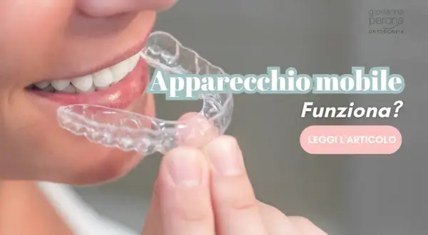Dente allineato con un apparecchio mobile trasparente. Scopri se funziona davvero.