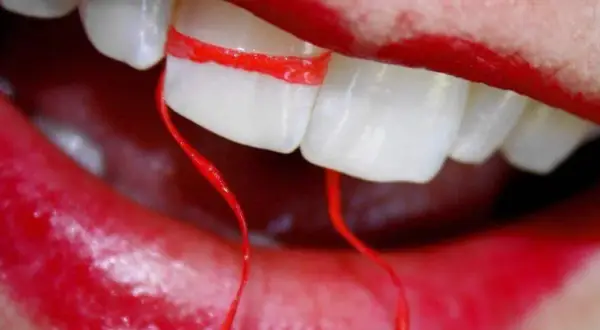 Un filo interdentale rosso avvolge due denti, creando un effetto visivo che sembra allargare i denti. Le labbra rosse incorniciano la scena.