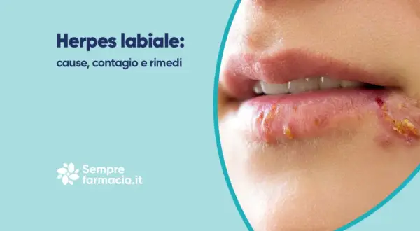 Labbra con herpes, un disturbo comune. Scopri cause, contagio e rimedi per il herpes lingua.
