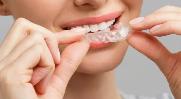 Sorriso smagliante con mascherine denti prima e dopo. La trasparenza delle mascherine invisibili per un sorriso perfetto.