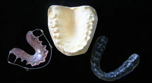 Modello dentale e apparecchi ortodontici, inclusi apparecchi invisibili per adulti, su sfondo nero.