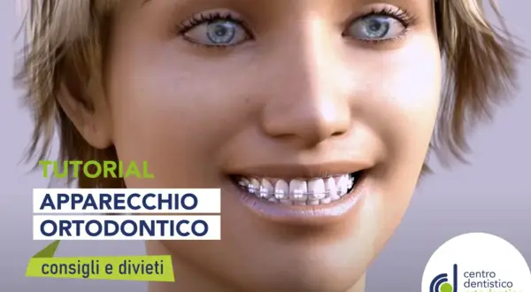 Tutorial apparecchio ortodontico: scopri se si possono mangiare le patatine con l'apparecchio e altri consigli utili.