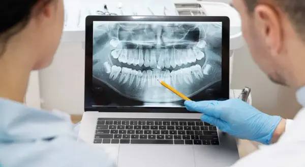 Dentisti analizzano un'ortopanoramica dentale su un laptop, seguendo il principio Alara per minimizzare l'esposizione.