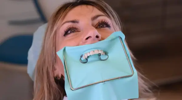Donna con diga di gomma dentista, pronta per un trattamento.