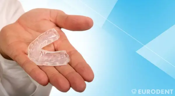 Mano che tiene un bite apparecchio trasparente, utile per proteggere i denti durante il sonno o lo sport.